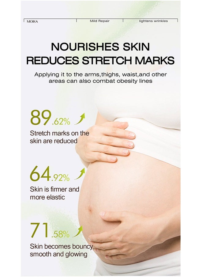 MOIKA - Antipregnancy Wrinkle Cream-Natural Plant Essence Formula Maternity Skin Treatmentpregnancy Scarsrepair Cream 50g - Image 1