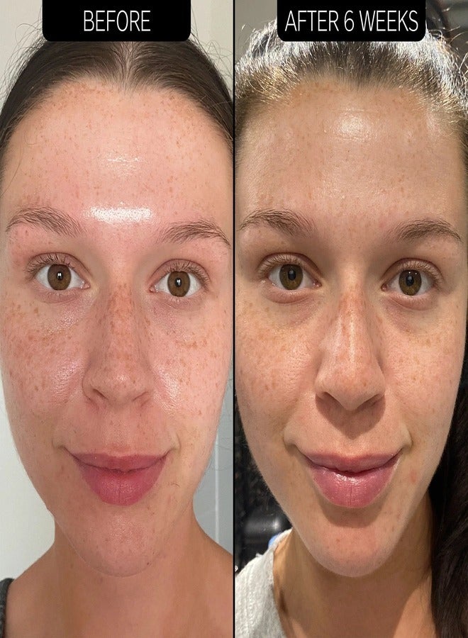 The INKEY List THE INKEY LIST SuperSolutionsᐩ 20% Niacinamide Serum 30ml  - Image 5