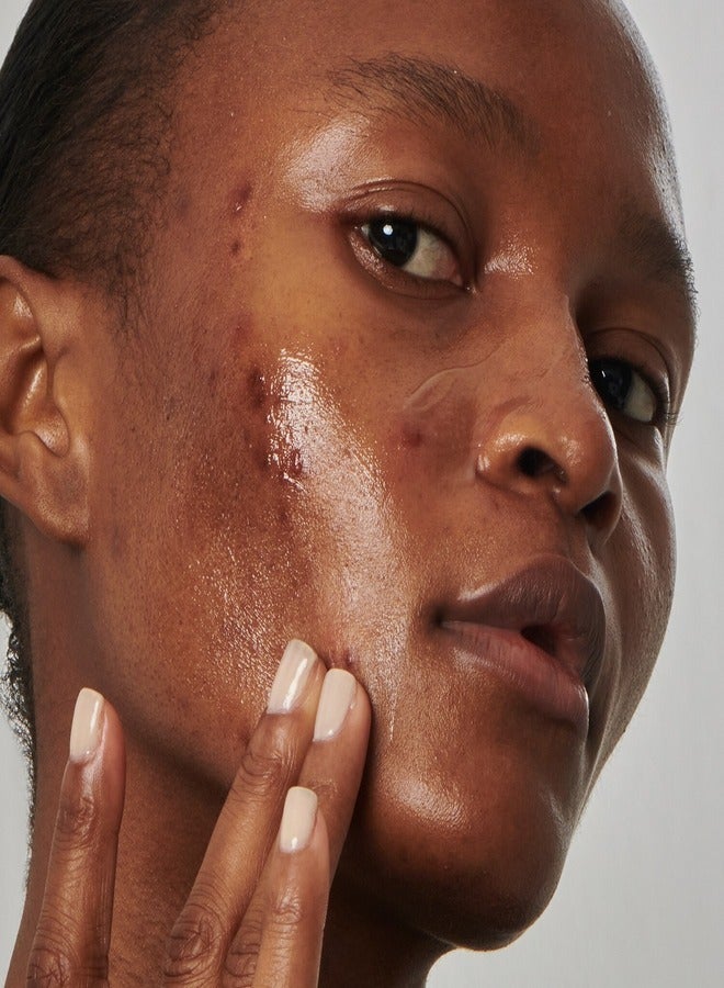 The INKEY List THE INKEY LIST SuperSolutionsᐩ 20% Niacinamide Serum 30ml  - Image 2