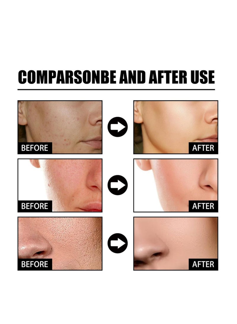 إيلهو كريم الوجه بالريتينول ، كريم الوجه المضاد للشيخوخة بالريتينول بنسبة 2.5٪ ، كريم الوجه المضاد للتجاعيد ، مصل للعناية بالبشرة ، كريم الترطيب العميق للجنسين ، شد التجاعيد 50 جرام - Image 2