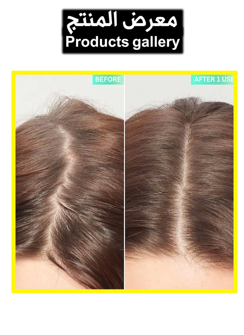 The Inkey List Glycolic Acid Exfoliating Scalp Scrub, Removes Product Build Up and Boosts Healthy Hair Growth, 5.07 fl oz  - Image 2