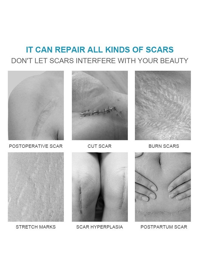 LANEMAY Scar Disappears - Medical Grade Silicone Scar Removl Cream,Dilute Hyperplasia Surgery Burn Scald Repair Scar Cream,Stretch Marks, Acne, Surgery, Effective for Both Old and New Scars 20g - Image 5