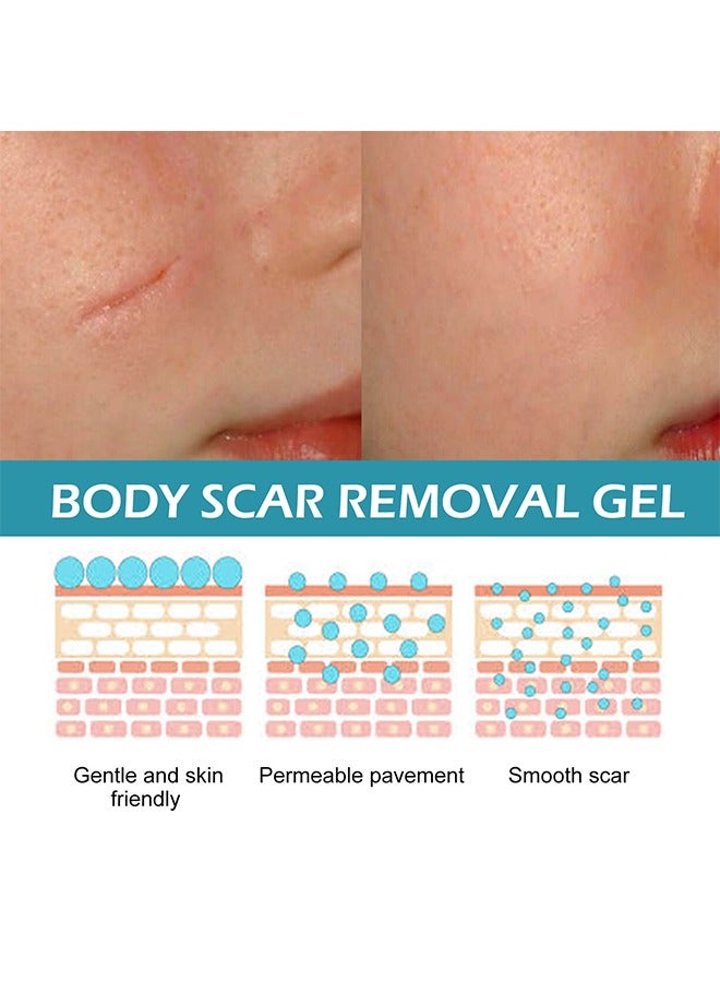 LANEMAY Scar Disappears - Medical Grade Silicone Scar Removl Cream,Dilute Hyperplasia Surgery Burn Scald Repair Scar Cream,Stretch Marks, Acne, Surgery, Effective for Both Old and New Scars 20g - Image 4