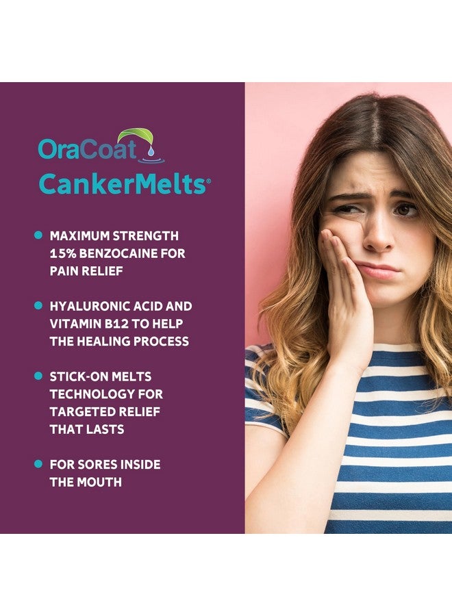 Oracoat ® Cankermelts® Stick-On Melts™ Mouth Sore Treatment, 20 Count - Image 2
