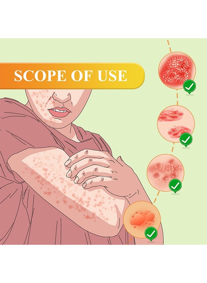 SOUTH MOON Bee Venom Psoriasis Cream, New Zealand Bee Venom Professional Psoriasis Cream For Itchy Skin Fast Relief Cream For Face And Body, Soothing And Moisturizing Psoriasis Cream 20G  - Image 3