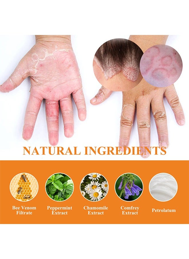 SOUTH MOON Bee Venom Psoriasis Cream, New Zealand Bee Venom Professional Psoriasis Cream For Itchy Skin Fast Relief Cream For Face And Body, Soothing And Moisturizing Psoriasis Cream 20G  - Image 2