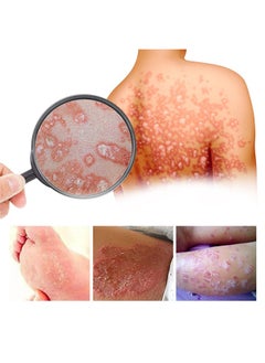 SOUTH MOON Bee Venom Psoriasis Cream, New Zealand Bee Venom Professional Psoriasis Cream For Itchy Skin Fast Relief Cream For Face And Body, Soothing And Moisturizing Psoriasis Cream 20G  - Image 4