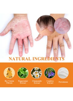 SOUTH MOON Bee Venom Psoriasis Cream, New Zealand Bee Venom Professional Psoriasis Cream For Itchy Skin Fast Relief Cream For Face And Body, Soothing And Moisturizing Psoriasis Cream 20G  - Image 2