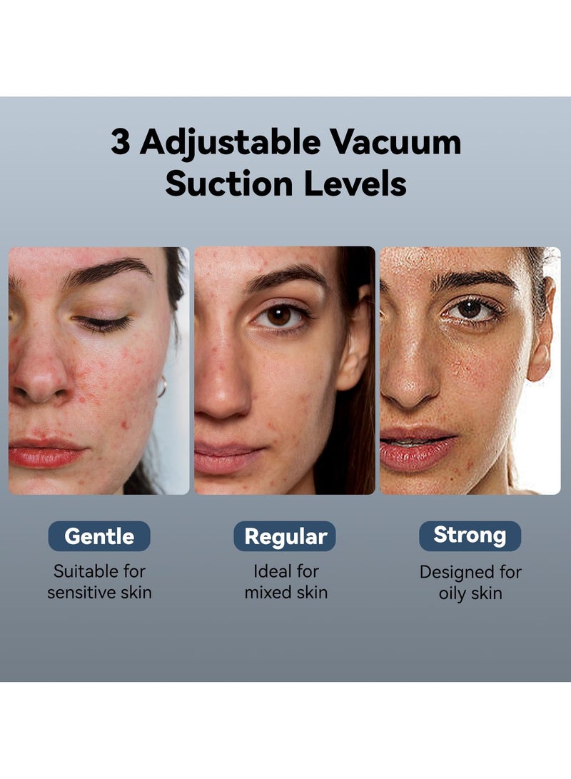 ASIV Blackhead remover pore vacuum cleaner, 5-in-1 blackhead removal tool, with cold and hot compression, blackhead extractor, with 3 suction powers,2 suction cups, facial vacuum pore cleaner, suitable for both men and women  - Image 4
