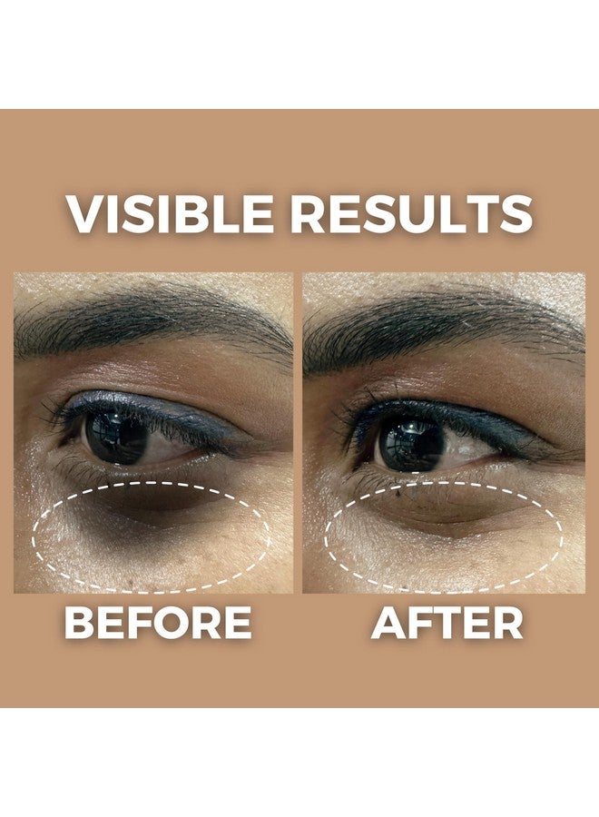 The Tribe Concepts Under Eye Brightening Oil for Dark Circles Removal, Reduces Puffiness Fine Lines, Wrinkles, Aging, Eye Pigmentation with Star Anise, Amla, Lodhra 100% Natural for Men/Women - 8 ml - Image 5