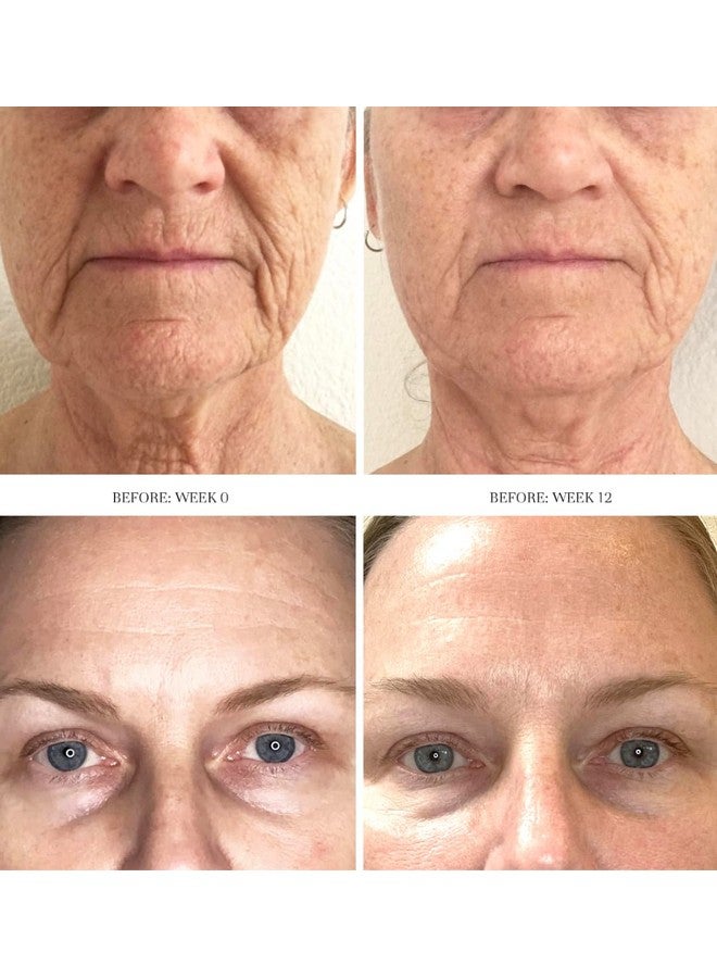 City Beauty Dermal Reset Exfoliating Concentrate - Aha Lactic Acid Daily Facial Exfoliant - Solution For Wrinkles, Texture, Discoloration, & Pores - Anti-Aging Cruelty-Free Skin Care - Image 2