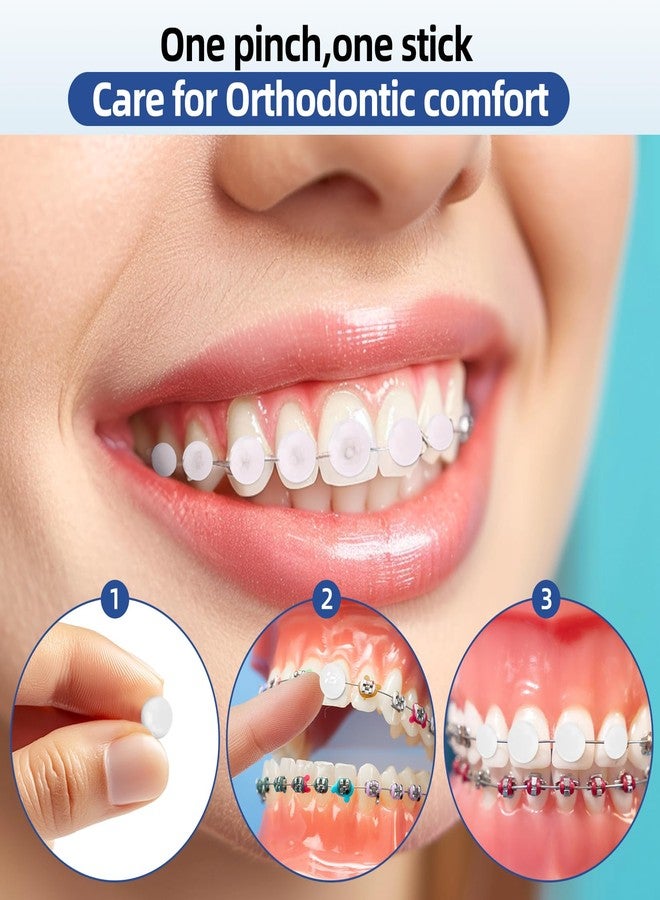 RAZOKO Orthodontic Wax for Braces Wax Dots 120 Individual Hygienic Packaging Dental Wax Mint - Image 4