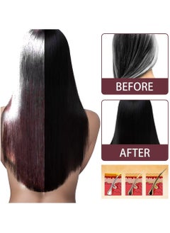 SOUTH MOON Herbal Shouwu Anti White Hair Spray Hair Growth Liquid Hair Dye Anti-hair Loss Nourish Hair Care White Grey Hair To Black Hair  - Image 4