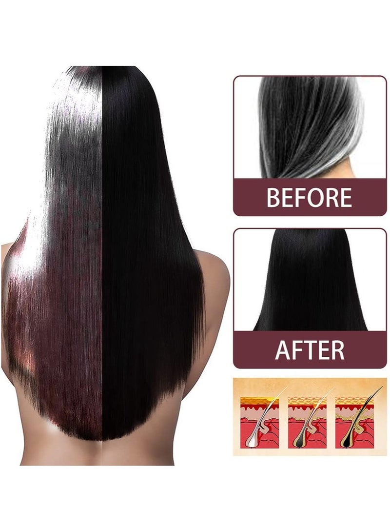 SOUTH MOON Herbal Shouwu Anti White Hair Spray Hair Growth Liquid Hair Dye Anti-hair Loss Nourish Hair Care White Grey Hair To Black Hair - Image 4