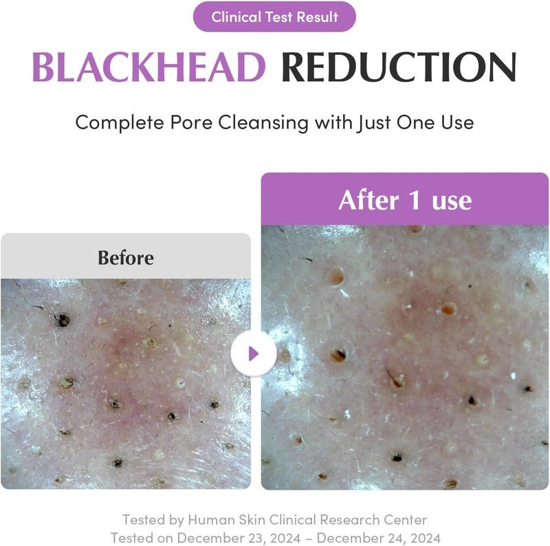 eqqualberry Purple Rice Pore Purifying Pack Cleanser - Dual-Use Clay Mask & Foam Cleanser | Deep Cleansing for Pore Care & Skin Prep | AHA+BHA+PHA | Korean Skincare for Glass Skin, 4.58 OZ. (130g) - Image 5