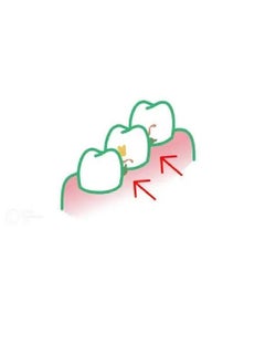 Gum Trav-Ler Interdental Brush 0.8Mm Red  - Image 5