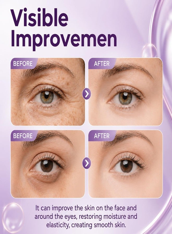 Calcium Anti-Aging Eye Cream 2 Pack, Firming Formula for Dark Circles, Puffy Bags & Sagging Skin, 15g - Image 3