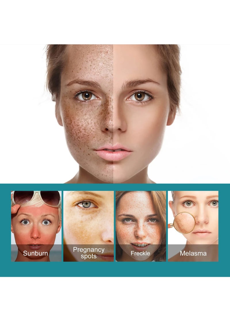 EELHOE كريم تبييض بقع داكنة يزيل النمش ويخفف البقع الداكنة ويوحد لون البشرة ويضيء complexion ويزيل النمش ويعزز الترطيب العميق مصحح البقع الداكنة 20 جرام - Image 3