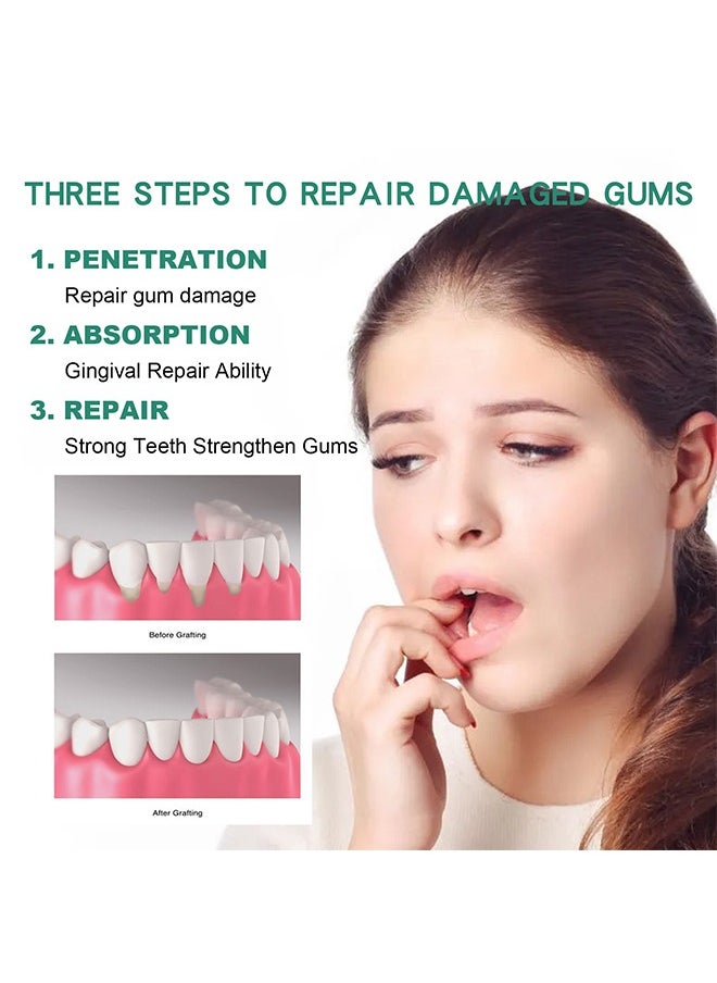 SOUTH MOON - Gum Repair Drops 30ml,Rejuvenate Your Gums Drops,Natural Gum Restore Drops,Gum Regrowth for Receding Gums Drops,Gum Therapy Drops,Gingival Repair Drops,Gum Regrowth Drops,Oil Pulling for Gums - Image 1