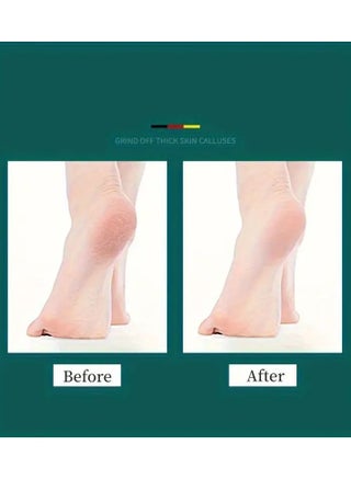 Professional Pedicure Foot File - Dual-Sided Callus Remover, Dead Skin Exfoliator, Durable Heel Scraper, Plastic Material, Unscented - Essential Foot Care Tool for Soft Smooth Feet - view 5