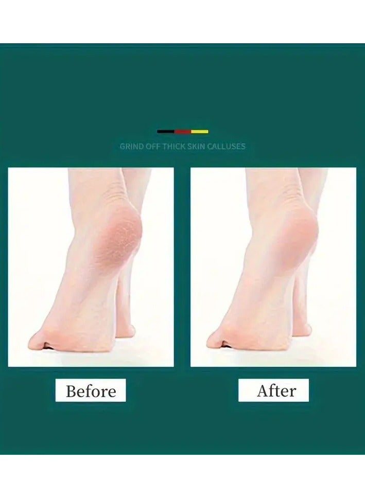 Goolsky Professional Pedicure Foot File - Dual-Sided Callus Remover, Dead Skin Exfoliator, Durable Heel Scraper, Plastic Material, Unscented - Essential Foot Care Tool for Soft Smooth Feet - Image 5