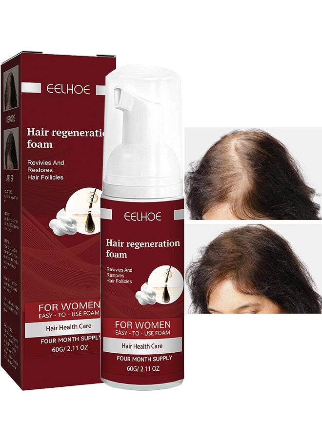 Hair Regeneration Foam For Women, Women's 5% Minoxidil Foam For Hair Thinning And Hair Loss, Hair Regeneration Foam Revivies And Restores Hair Follicles 60G - pzsku/ZF8C147510A8F5B6EE17FZ/45/_/1719561728/316a8cfc-77aa-4fca-ba2c-d05e8ad8b00d