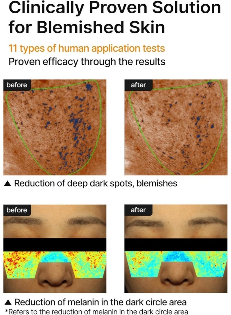 celimax Korean beauty Pore and Dark Spot Brightening Cream 35ml, for dark spots, melasma and hyperpigmentation - Image 5