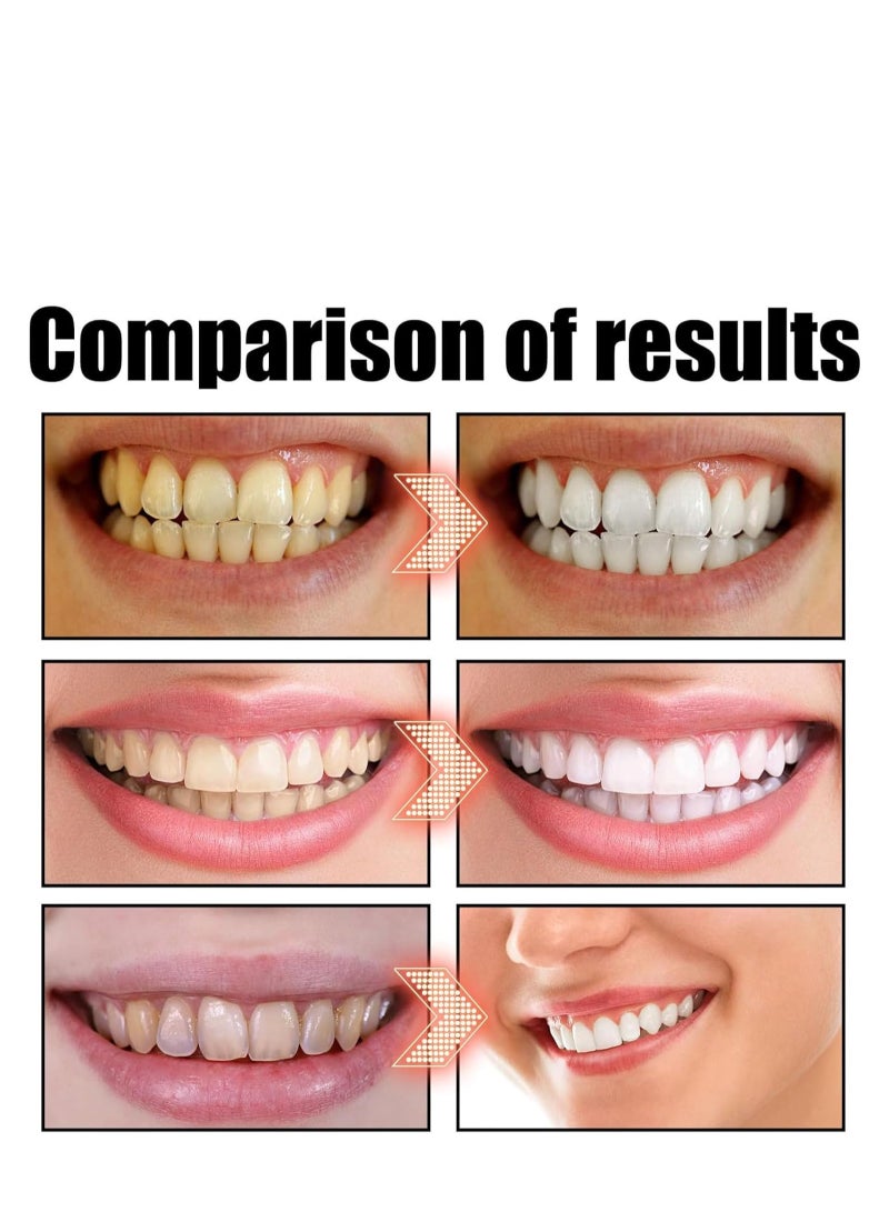 Sp-6 Ultra Whitening Toothpaste, Sp-6 Probiotics Whitening Toothpaste, MS DRWIKEY Probiotics Bright White Toothpaste, Msdrwikey Sp-6 Toothpaste Oral Health Management, Fresh Breath (Red) - Image 5