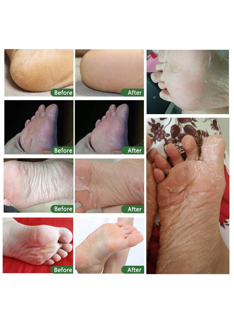 Pack Of 5 Tea Tree Exfoliating Foot Mask - pzsku/ZF8D4A56E5175AA69FE85Z/45/_/1686642851/f557b1a5-44e7-4e4a-9ac7-7a7642bf1804