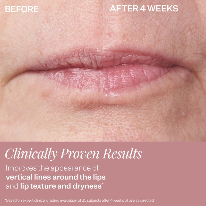 StriVectin DoubleFix for Lips 2-in-1 Lip Fix Plumping Treatment & Vertical Line Treatment - Image 5