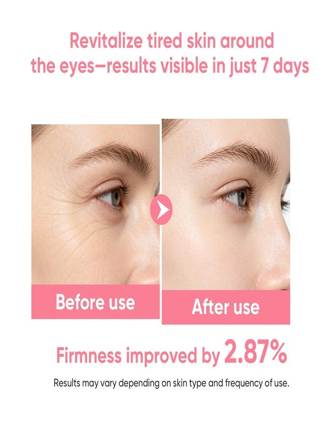 OUPEICHARM OUPEICHAN Lifting and Firming Eye Cream – Glow & Firming Under Eye Serum with Peptide & 5D Hyaluronic Acid Eye Cream,Reduces Fine Lines, Hydrates & Firms, Gentle for Sensitive Eyes 1.06 oz - Image 4