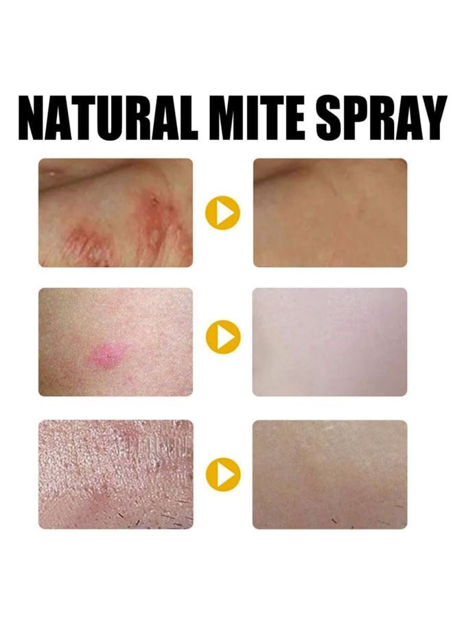 Generic Mite Exterminating Bedbug Killer Pet Cleaner Allergy & Asthma Relief   Removes Dust Mites from Home Bed Pet Bedding  Eliminates Flea Bedbug Mite  Pet & Children Friendly  Long-lasting Spray  100ml  - Image 2