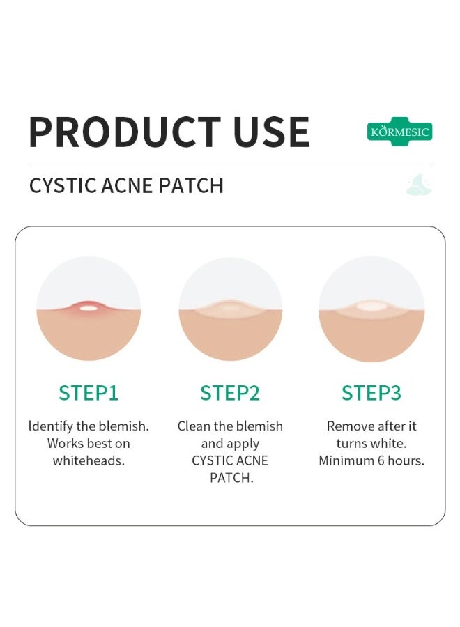 Kormesic Acne Pimple Patch 36pcs/Box - Image 2