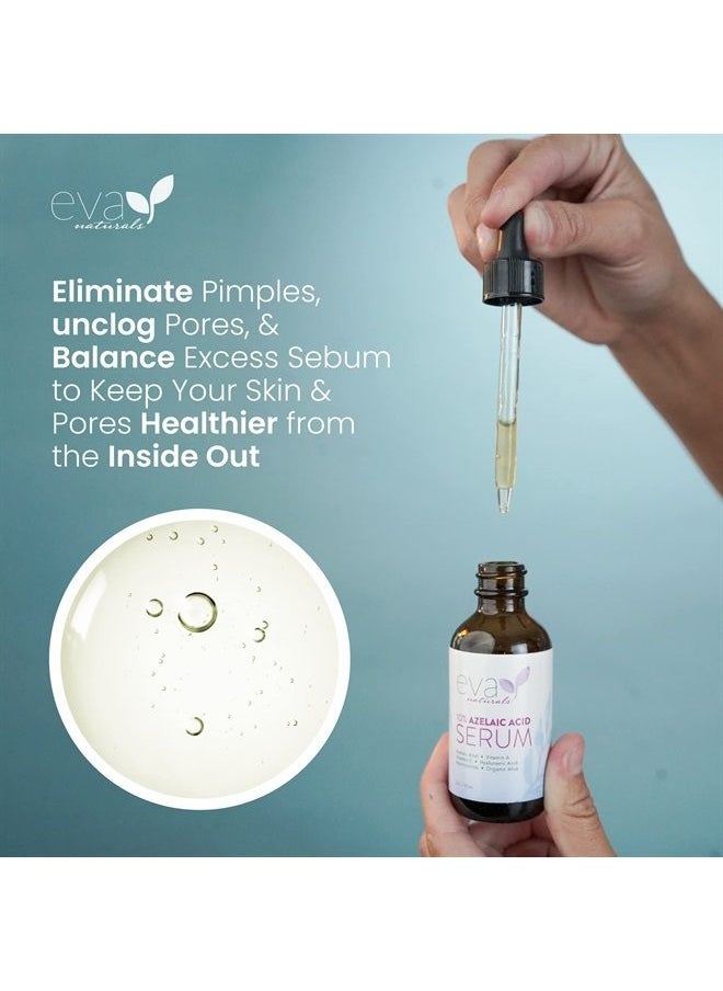 Eva Naturals مصل الوجه بحمض الأزيليك 10%، 2 أونصة، حمض الهيالورونيك لتفتيح البشرة والنياسيناميد، تخفيف الاحمرار، إزالة البقع الداكنة وإصلاحها  - Image 2