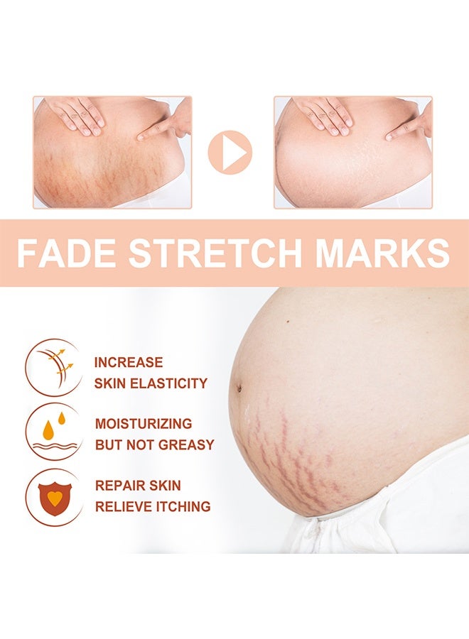 wiieey Snail Essence Pregnancy Stretch Mark Cream, Stretch Marks And Scar Removal Cream For Pregnancy, Stretch Marks Scar Belly Creams For Wrinkles 60ml - Image 3