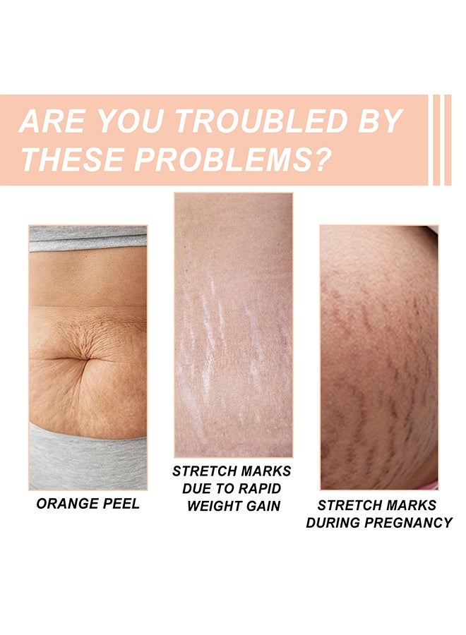 wiieey Snail Essence Pregnancy Stretch Mark Cream, Stretch Marks And Scar Removal Cream For Pregnancy, Stretch Marks Scar Belly Creams For Wrinkles 60ml - Image 2