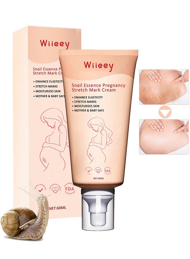 wiieey Snail Essence Pregnancy Stretch Mark Cream, Stretch Marks And Scar Removal Cream For Pregnancy, Stretch Marks Scar Belly Creams For Wrinkles 60ml - Image 1