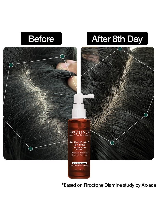 Soulflower Anti Dandruff Hair Serum with Piroctone Olamine, 2% Salicylic Acid & Rosemary Essential Oil for Hair Growth, Anti Hair Fall, Frizz Control Lotion for Men & Women for All Hair Types | 50ml - Image 2