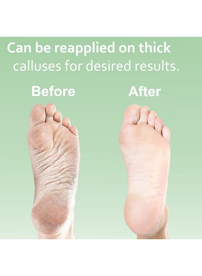 EntreFeet Dr. Entre's Callus Remover Gel & Foot File: Extra Strength Callus Remover for Feet, Foot Callus Remover Care, Pedicure Tools Supplies, Spa Kit, Dead Skin Scrubber, 4 oz - Image 5