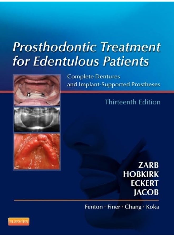 Prosthodontic Treatment for Edentulous Patients