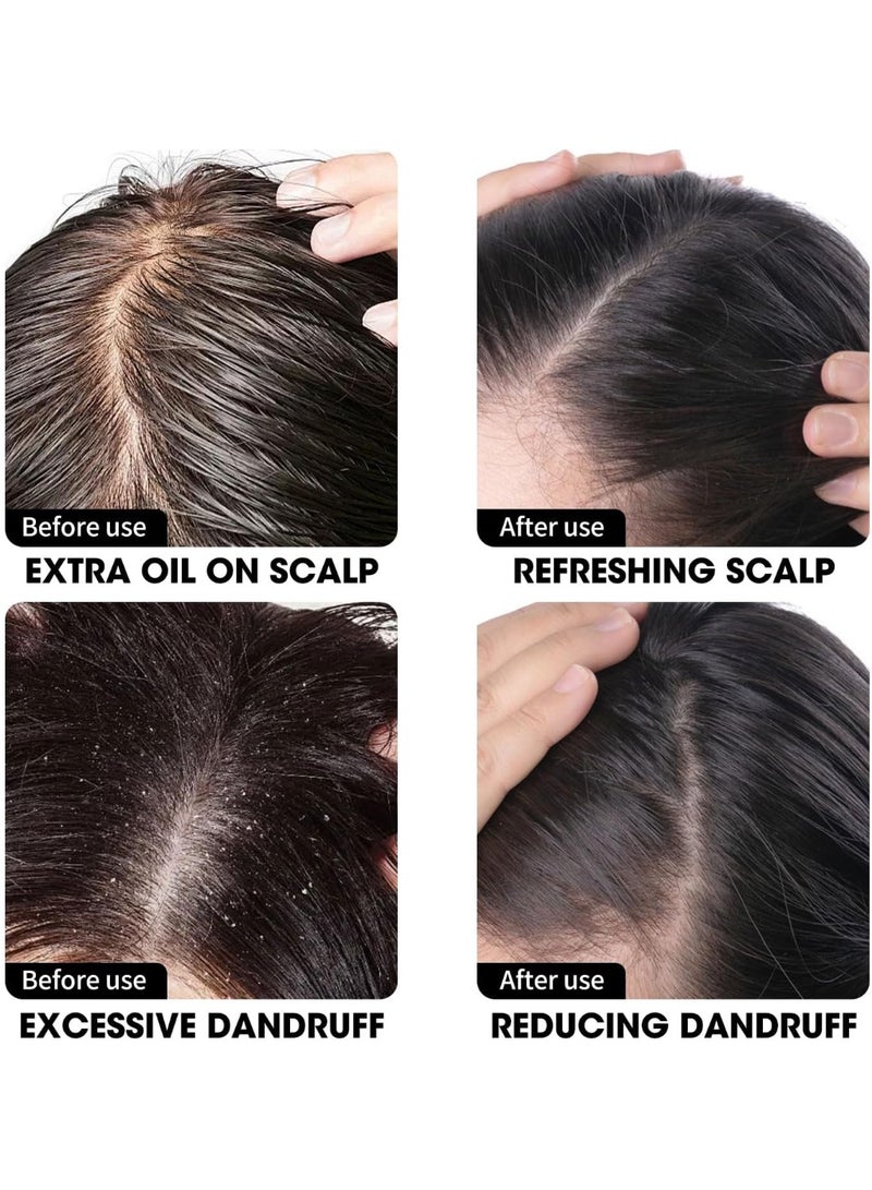 CNMOFAXIN Anti Dandruff Shampoo for Men & Women (480ml) - Scalp Deep Cleansing Formula for Itchy Scalp Relief, Flake Control & Excess Sebum Care - Daily Use Shampoo for All Hair Types - Gentle & Natural Ingredients  - Image 5