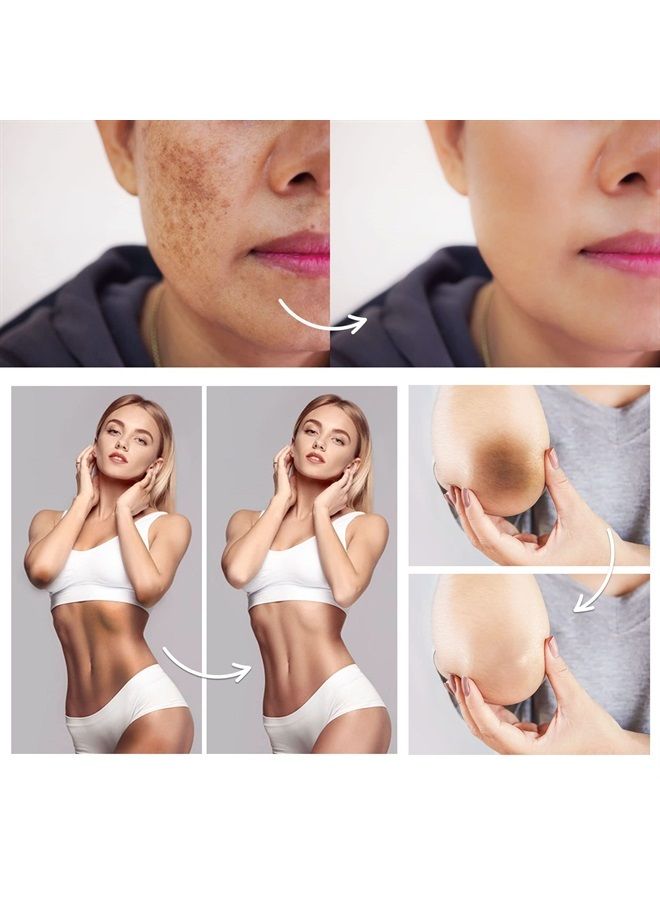 Famirosa كريم مصحح للبقع الداكنة للمنطقة الحميمة - كريم تحت الإبط للإبط والركبتين والمرفقين والفخذ الداخلي والأجزاء الخاصة - كريم للبشرة الحميمة - Image 3