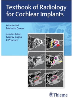 Textbook of Radiology for Cochlear Implants 