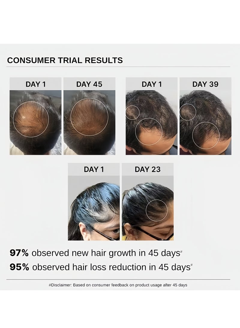 كارفينشي Bare Anatomy Advanced Hair Growth Serum| 3% Redensyl (ريدينسيل) - نتائج أفضل بمرتين من المينوكسيديل | + 4% Anagain (أناغين) + 3% Baicapil (بايكابيل) | إكليل الجبل (الروزماري)، البيوتين | مصيب نمو الشعر والتحكم في تساقط الشعر للنساء والرجال | 30 مل - Image 5