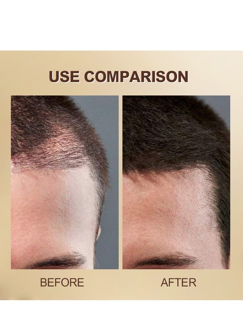 ايه اي اس تي اتش تي ايه ان واي 2 قطعة من زيت شعر الروزماري لنمو الشعر وصحة فروة الرأس والشعر المجعد مع زيت الخروع وزيت اللوز - Image 4