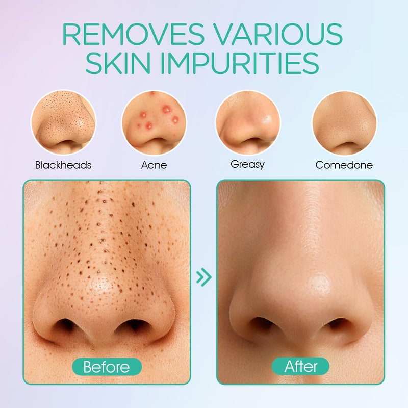 VOYOR Blackhead Remover Pore Vacuum - Electric Face Vacuum Pore Cleaner Acne White Heads Removal with 6 Suction Heads (BR410) - Image 3