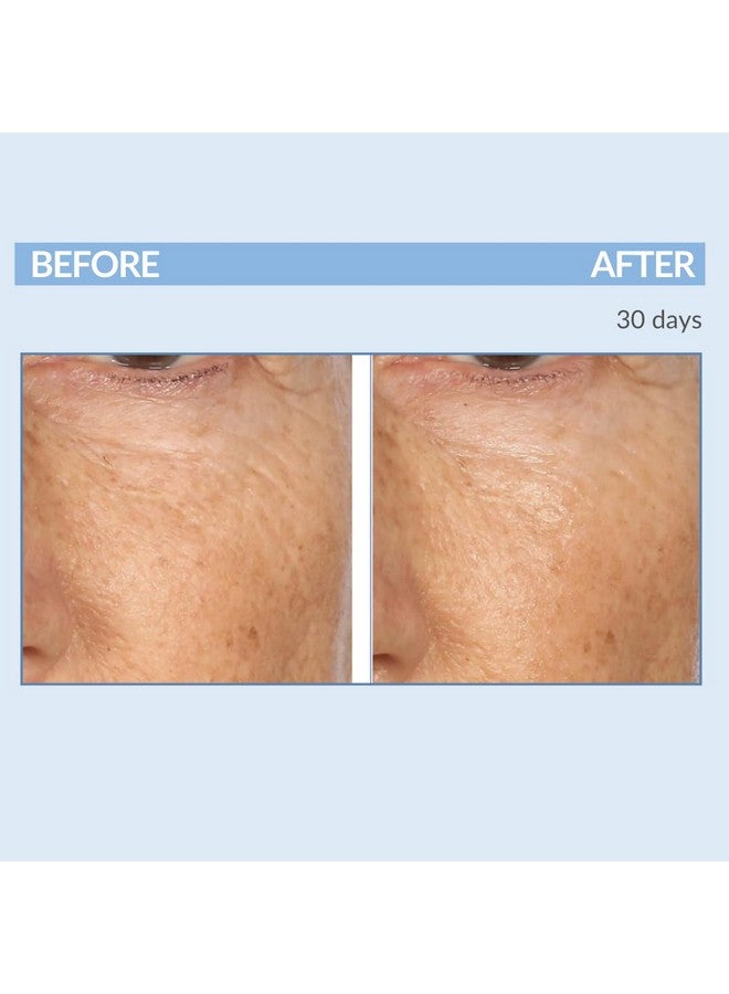 Serious Skincare Retinol Facial Care DUO - A Force XR Serum Concentrate & A Cream XR Moisture Cream for Face - With Vitamin C - Anti-Aging for Lines, Wrinkles - Resurfaces and Hydrates Skin - Image 5