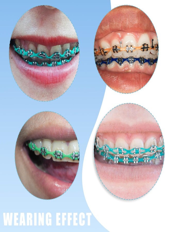 SEAVERRS سلسلة تقويم أسنان بطول 20 سم، سلسلة مطاطية متصلة بـ 24 لونًا مع أداة، أربطة تقويم أسنان قابلة لإعادة الاستخدام للمراهقين والبالغين، ملحق للعناية بالفم يمكنك تركيبه بنفسك - Image 4
