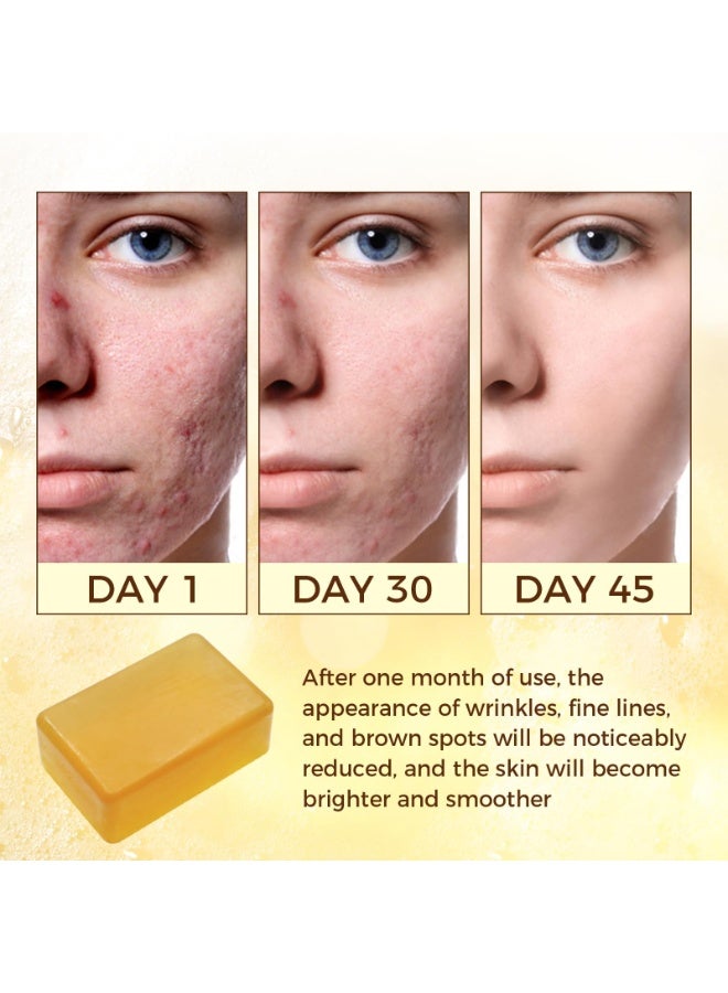 OUKEYA Kojic Acid Dark Spot Remover Soap, Turmeric Soap Bar with Vitamin C,Retinol, Collagen & Shea Butter, Hydrating Face & Body Wash Infused with Hyaluronic Acid - Image 4