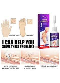 SOUTH MOON Wart Removal Liquid 20ml, Smoothes Skin Gentle Fast Acting Gel Wart Removal For Plantar Wart Flat Warts And Corns  - Image 2